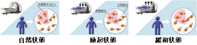 CT検査とMRI検査の違い|撮影原理・画像・検査費用・検査のながれetc