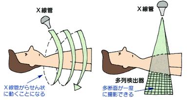 CT検査とMRI検査の違い|撮影原理・画像・検査費用・検査のながれetc