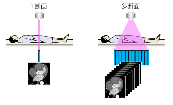CT検査をわかりやすく解説|検査のながれ・分かる病気・被ばく量・検査時間・検査費用etc