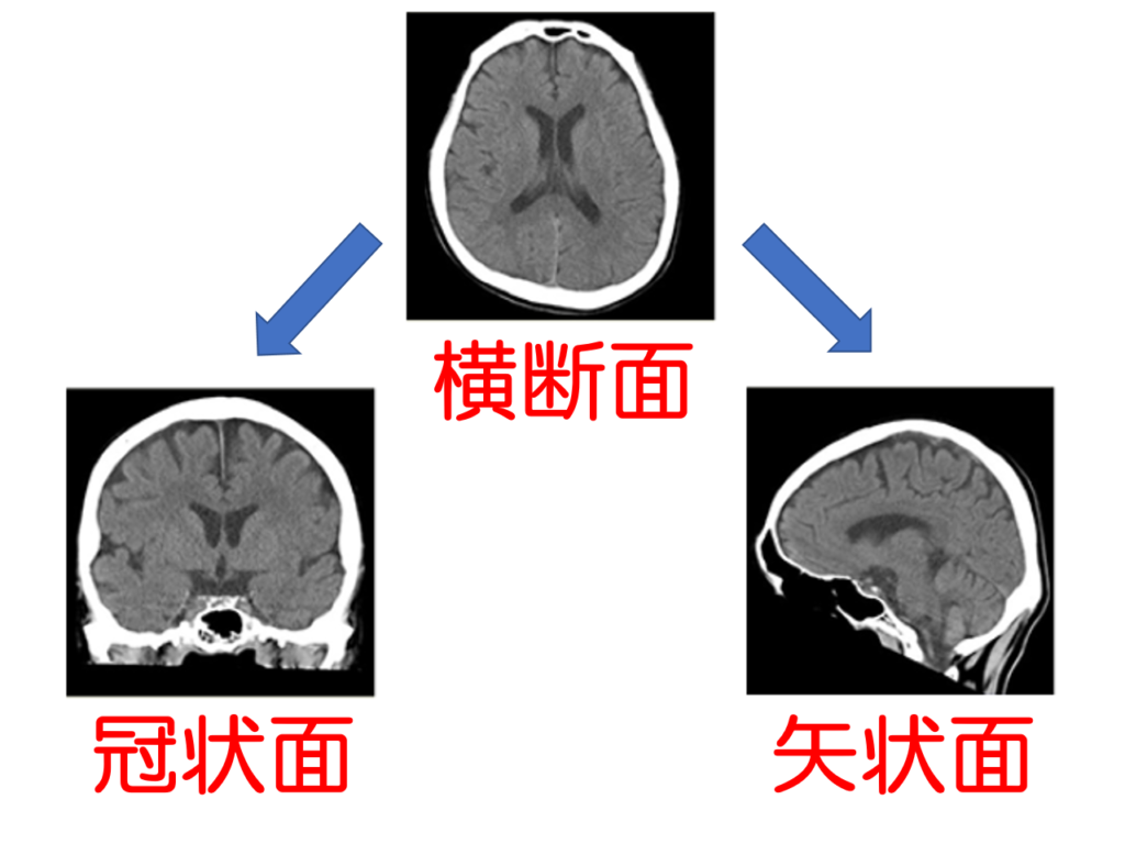 CT検査をわかりやすく解説|検査のながれ・分かる病気・被ばく量・検査時間・検査費用etc