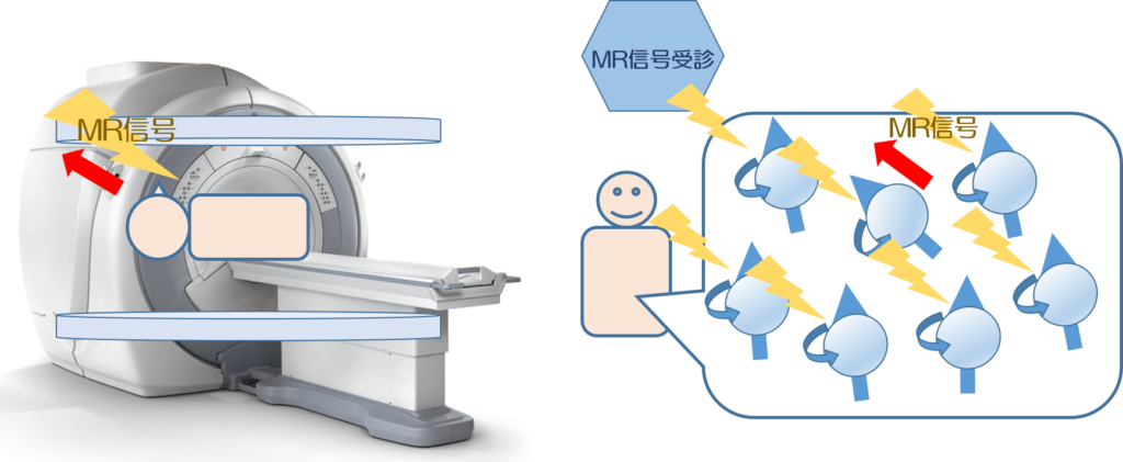 MRI検査をわかりやすく解説|検査のながれ・分かる病気・検査時間・検査費用etc