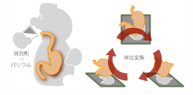 胃透視と胃カメラの違い|どちらの検査を受ければよいのか?
